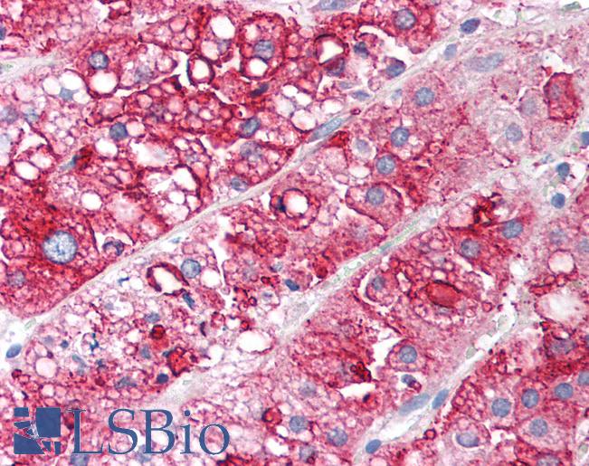 SCARB1 / SR-BI Antibody - Anti-SR-BI antibody IHC of human adrenal cortex. Immunohistochemistry of formalin-fixed, paraffin-embedded tissue after heat-induced antigen retrieval. Antibody dilution 1:400. This image was taken for the unconjugated form of this product. Other forms have not been tested.