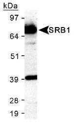 SCARB1 / SR-BI Antibody - Immunolocalization of SR-BI in adult mink testis. SR-BI labeling is visible at the surface and along the outline of the large vacuole. Photo courtesy of R.M. Pelletier, University of Montreal.  This image was taken for the unconjugated form of this product. Other forms have not been tested.