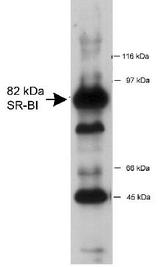 SCARB1 / SR-BI Antibody - Detection of SR-BI in 20 ug of mouse liver lysate using Scavenger Receptor BI (SR-BI) Antibody (lot F) at a 1:1,000 dilution.  This image was taken for the unconjugated form of this product. Other forms have not been tested.