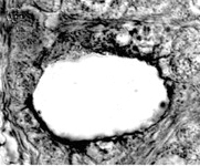 SCARB1 / SR-BI Antibody - Immunolocalization of SR-BI in adult mink testis using NB4 LS-2882. SR-BI labeling is visible at the surface and along the outline of the large vacuole. Photo courtesy of R.M. Pelletier, University of Montreal.  This image was taken for the unconjugated form of this product. Other forms have not been tested.