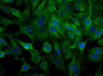 SCARB1 / SR-BI Antibody - Detection of SR-BI in mouse liver lysate (20 ug). ECL detection 5 seconds.  This image was taken for the unconjugated form of this product. Other forms have not been tested.