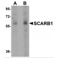 SCARB1 / SR-BI Antibody - Western blot analysis of SCARB1 in human spleen tissue lysate with SCARB1 antibody at (A) 1 and (B) 2 µg/mL.