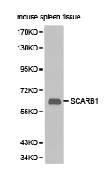 SCARB1 / SR-BI Antibody - Western blot of extracts of mouse spleen tissue, using SCARB1 antibody.