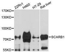 SCARB1 / SR-BI Antibody - Western blot analysis of extracts of various cell lines.