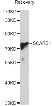 SCARB1 / SR-BI Antibody - Western blot analysis of extracts of rat ovary, using SCARB1 antibody at 1:1000 dilution. The secondary antibody used was an HRP Goat Anti-Rabbit IgG (H+L) at 1:10000 dilution. Lysates were loaded 25ug per lane and 3% nonfat dry milk in TBST was used for blocking. An ECL Kit was used for detection and the exposure time was 90s.