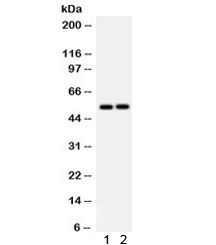 SCARB1 / SR-BI Antibody