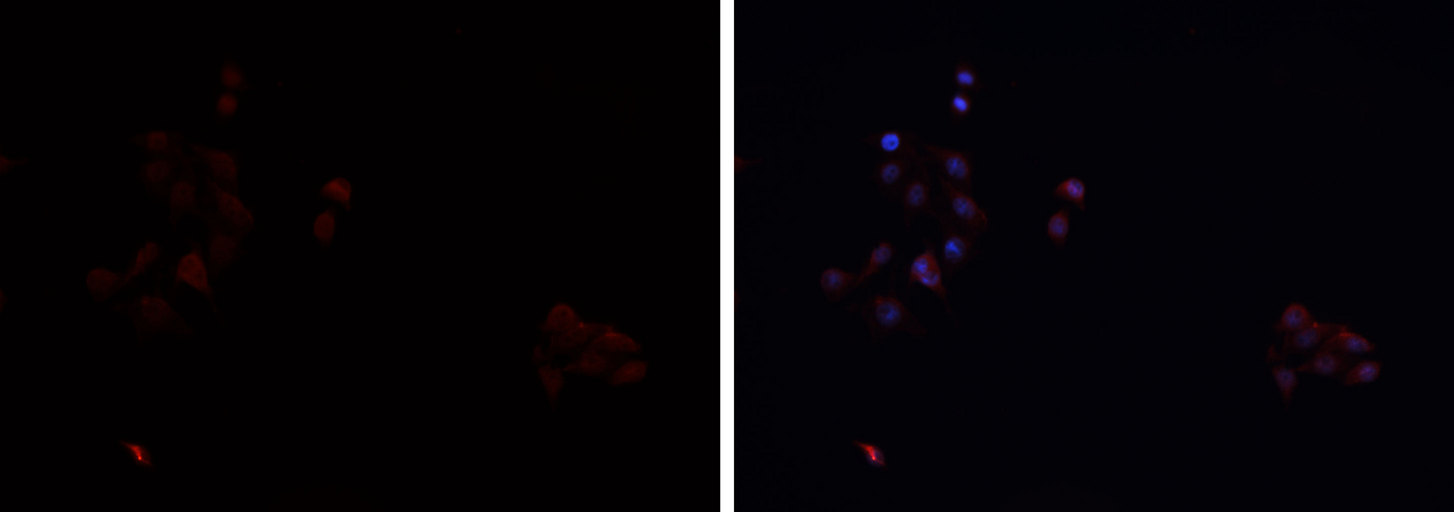 SCARB1 / SR-BI Antibody - Staining HepG2 cells by IF/ICC. The samples were fixed with PFA and permeabilized in 0.1% Triton X-100, then blocked in 10% serum for 45 min at 25°C. The primary antibody was diluted at 1:200 and incubated with the sample for 1 hour at 37°C. An Alexa Fluor 594 conjugated goat anti-rabbit IgG (H+L) antibody, diluted at 1/600 was used as secondary antibody.