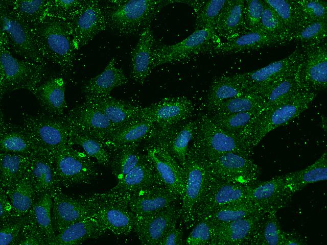 SCARB1 / SR-BI Antibody - Immunofluorescence staining of SCARB1 in U2OS cells. Cells were fixed with 4% PFA, permeabilzed with 0.1% Triton X-100 in PBS, blocked with 10% serum, and incubated with rabbit anti-Human SCARB1 polyclonal antibody (dilution ratio 1:100) at 4°C overnight. Then cells were stained with the Alexa Fluor 488-conjugated Goat Anti-rabbit IgG secondary antibody (green) and counterstained with DAPI (blue). Positive staining was localized to Cytoplasm.