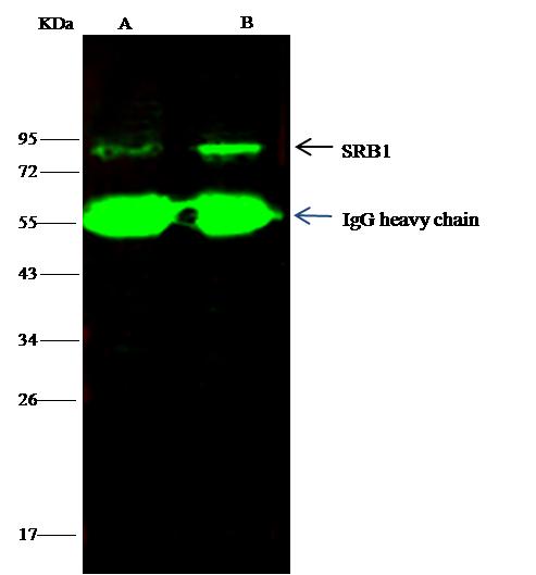 SCARB1 / SR-BI Antibody - SRB1 was immunoprecipitated using: Lane A: 0.5 mg Hela Whole Cell Lysate. Lane B: 0.5 mg HepG2 Whole Cell Lysate. 1 uL anti-SRB1 rabbit polyclonal antibody and 15 ul of 50% Protein G agarose. Primary antibody: Anti-SRB1 rabbit polyclonal antibody, at 1:500 dilution. Secondary antibody: Dylight 800-labeled antibody to rabbit IgG (H+L), at 1:5000 dilution. Developed using the odssey technique. Performed under reducing conditions. Predicted band size: 60 kDa. Observed band size: 81 kDa.