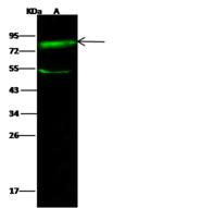 SCARB1 / SR-BI Antibody - Anti-SRB1 rabbit polyclonal antibody at 1:500 dilution. Lane A: HepG2 Whole Cell Lysate. Lysates/proteins at 30 ug per lane. Secondary: Goat Anti-Rabbit IgG H&L (Dylight 800) at 1/10000 dilution. Developed using the Odyssey technique. Performed under reducing conditions. Predicted band size: 60 kDa. Observed band size: 81 kDa. (We are unsure as to the identity of these extra bands.)