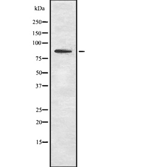 SCARF1 / SREC Antibody - Western blot analysis of SCARF1 using HuvEc whole lysates.