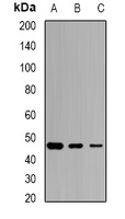 SCCPDH Antibody - Western blot analysis of SCCPDH expression in THP1 (A); PC3 (B); mouse heart (C) whole cell lysates.