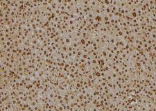 SCCPDH Antibody - 1:100 staining mouse liver tissue by IHC-P. The sample was formaldehyde fixed and a heat mediated antigen retrieval step in citrate buffer was performed. The sample was then blocked and incubated with the antibody for 1.5 hours at 22°C. An HRP conjugated goat anti-rabbit antibody was used as the secondary.