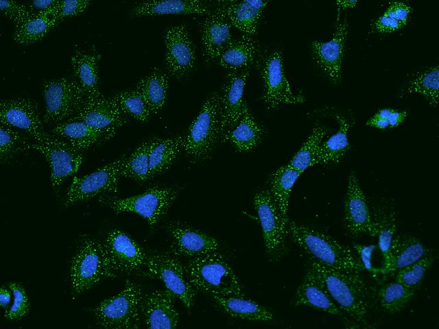 SCCPDH Antibody - Immunofluorescence staining of SCCPDH in U2OS cells. Cells were fixed with 4% PFA, permeabilzed with 0.1% Triton X-100 in PBS, blocked with 10% serum, and incubated with rabbit anti-Human SCCPDH polyclonal antibody (dilution ratio 1:200) at 4°C overnight. Then cells were stained with the Alexa Fluor 488-conjugated Goat Anti-rabbit IgG secondary antibody (green) and counterstained with DAPI (blue). Positive staining was localized to Cytoplasm.
