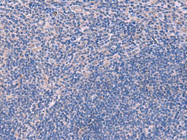 SCCPDH Antibody - Immunohistochemistry of paraffin-embedded Human tonsil tissue  using SCCPDH Polyclonal Antibody at dilution of 1:85(×200)