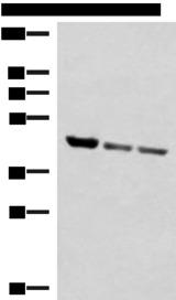 SCCPDH Antibody - Western blot analysis of Human fetal liver tissue PC-3 and A172 cell lysates  using SCCPDH Polyclonal Antibody at dilution of 1:1000