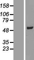 SCCPDH Protein - Western validation with an anti-DDK antibody * L: Control HEK293 lysate R: Over-expression lysate