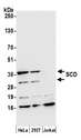 SCD1 / SCD Antibody - Detection of human SCD by western blot. Samples: Whole cell lysate (50 µg) from HeLa, HEK293T, and Jurkat cells prepared using NETN lysis buffer. Antibody: Affinity purified rabbit anti-SCD antibody used for WB at 0.4 µg/ml. Detection: Chemiluminescence with an exposure time of 30 seconds.