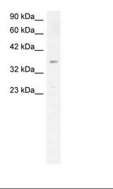 SCD1 / SCD Antibody - Fetal Liver Lysate.  This image was taken for the unconjugated form of this product. Other forms have not been tested.