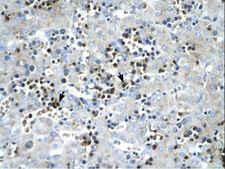 SCD1 / SCD Antibody - SCD antibody ARP32797_T100-NP_005054-SCD (stearoyl-CoA desaturase (delta-9-desaturase)) Antibody was used in IHC to stain formalin-fixed, paraffin-embedded human liver.  This image was taken for the unconjugated form of this product. Other forms have not been tested.