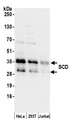 SCD1 / SCD Antibody - Detection of human SCD by western blot. Samples: Whole cell lysate (50 µg) from HeLa, HEK293T, and Jurkat cells prepared using NETN lysis buffer. Antibody: Affinity purified rabbit anti-SCD antibody used for WB at 0.1 µg/ml. Detection: Chemiluminescence with an exposure time of 10 seconds.