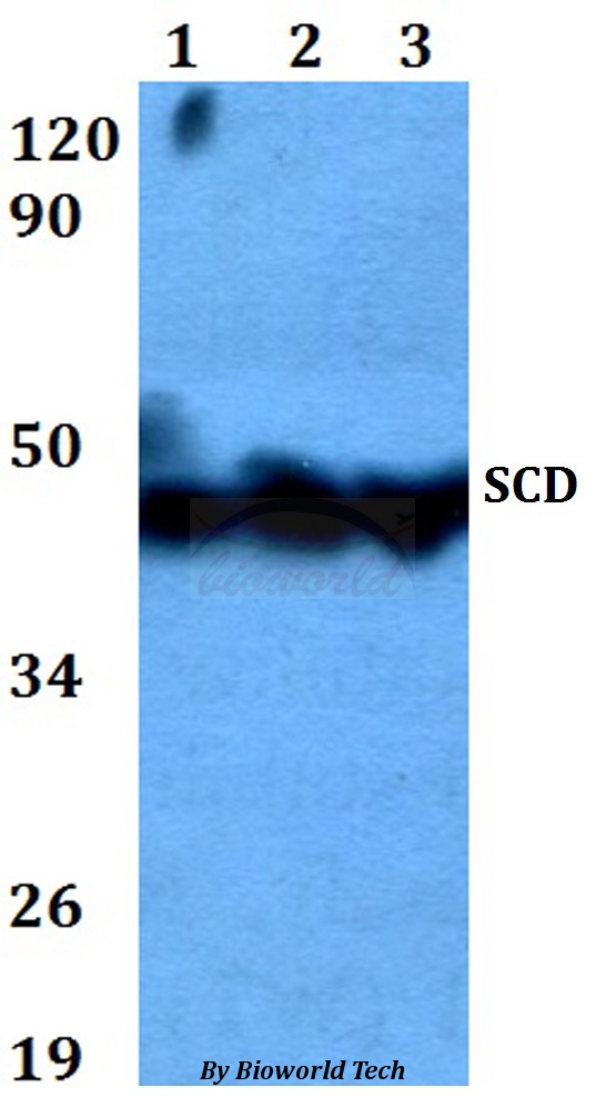 SCD1 / SCD Antibody - Western blot of SCD antibody at 1:500 dilution. Lane 1: HeLa whole cell lysate. Lane 2: sp2/0 whole cell lysate. Lane 3: PC12 whole cell lysate.