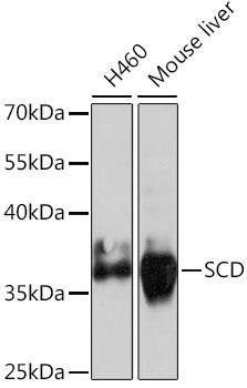 SCD1 / SCD Antibody - Western blot analysis of extracts of various cell lines using SCD Polyclonal Antibody at dilution of 1:1000.