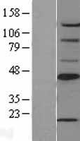 SCD1 / SCD Protein - Western validation with an anti-DDK antibody * L: Control HEK293 lysate R: Over-expression lysate