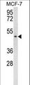 SCD5 / SCD4 Antibody - SCD5 Antibody western blot of MCF-7 cell line lysates (35 ug/lane). The SCD5 antibody detected the SCD5 protein (arrow).
