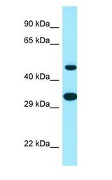 SCD5 / SCD4 Antibody - SCD5 / SCD4 antibody Western Blot of Human heart.  This image was taken for the unconjugated form of this product. Other forms have not been tested.