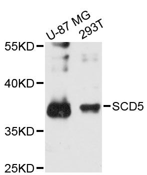SCD5 / SCD4 Antibody - Western blot analysis of extracts of various cell lines, using SCD5 antibody at 1:3000 dilution. The secondary antibody used was an HRP Goat Anti-Rabbit IgG (H+L) at 1:10000 dilution. Lysates were loaded 25ug per lane and 3% nonfat dry milk in TBST was used for blocking. An ECL Kit was used for detection and the exposure time was 90s.
