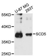SCD5 / SCD4 Antibody - Western blot analysis of extracts of various cell lines, using SCD5 antibody at 1:3000 dilution. The secondary antibody used was an HRP Goat Anti-Rabbit IgG (H+L) at 1:10000 dilution. Lysates were loaded 25ug per lane and 3% nonfat dry milk in TBST was used for blocking. An ECL Kit was used for detection and the exposure time was 90s.