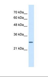 SCEH / ECHS1 Antibody - Jurkat cell lysate. Antibody concentration: 5.0 ug/ml. Gel concentration: 12%.  This image was taken for the unconjugated form of this product. Other forms have not been tested.