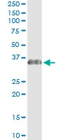 SCEH / ECHS1 Antibody - Immunoprecipitation of ECHS1 transfected lysate using anti-ECHS1 monoclonal antibody and Protein A Magnetic Bead, and immunoblotted with ECHS1 rabbit polyclonal antibody.