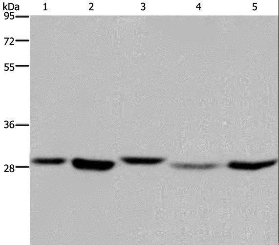 SCEH / ECHS1 Antibody - Western blot analysis of 293T, MCF-7 and PC3 cell, human fetal liver tissue and HeLa cell, using ECHS1 Polyclonal Antibody at dilution of 1:300.