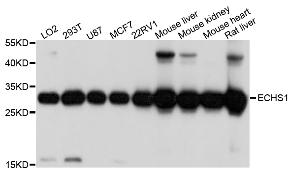 SCEH / ECHS1 Antibody - Western blot analysis of extracts of various cells.