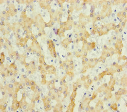 SCEH / ECHS1 Antibody - Immunohistochemistry of paraffin-embedded human liver tissue at dilution of 1:100