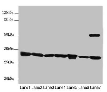 SCEH / ECHS1 Antibody - Western blot All Lanes: ECHS1 antibody at 3.03 ug/ml Lane 1: Mouse liver tissue Lane 2: Mouse skeletal muscle tissue Lane 3: Hela whole cell lysate Lane 4: HepG-2 whole cell lysate Lane 5: MCF7 whole cell lysate Lane 6: Jurkat whole cell lysate Lane 7: A549 whole cell lysate Secondary Goat polyclonal to rabbit IgG at 1/10000 dilution Predicted band size: 31 kDa Observed band size: 31,50 kDa