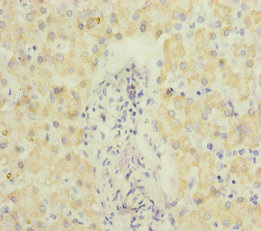 SCEH / ECHS1 Antibody - Immunohistochemistry of paraffin-embedded human liver tissue at dilution of 1:100