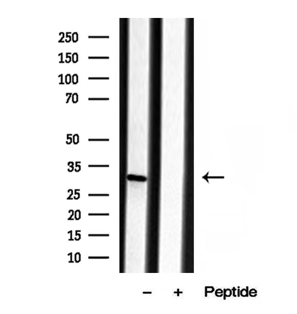 SCEH / ECHS1 Antibody - Western blot analysis of extracts of human liver tissue using ECHS1 antibody.