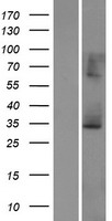 SCEH / ECHS1 Protein - Western validation with an anti-DDK antibody * L: Control HEK293 lysate R: Over-expression lysate