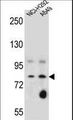 SCEL Antibody - SCEL Antibody western blot of NCI-H292,A549 cell line lysates (35 ug/lane). The SCEL antibody detected the SCEL protein (arrow).
