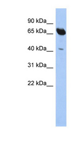 SCFD1 / SLY1 Antibody - SCFD1 antibody Western blot of HepG2 cell lysate. This image was taken for the unconjugated form of this product. Other forms have not been tested.