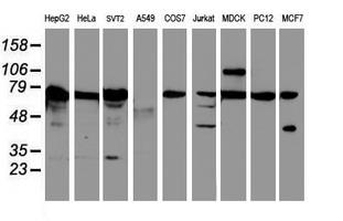SCFD1 / SLY1 Antibody - Western blot of extracts (35ug) from 9 different cell lines by using anti-SCFD1 monoclonal antibody.