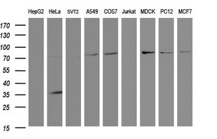 SCFD1 / SLY1 Antibody - Western blot of extracts (35ug) from 9 different cell lines by using anti-SCFD1 monoclonal antibody (HepG2: human; HeLa: human; SVT2: mouse; A549: human; COS7: monkey; Jurkat: human; MDCK: canine; PC12: rat; MCF7: human).