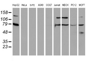 SCFD1 / SLY1 Antibody - Western blot of extracts (35 ug) from 9 different cell lines by using g anti-SCFD1 monoclonal antibody (HepG2: human; HeLa: human; SVT2: mouse; A549: human; COS7: monkey; Jurkat: human; MDCK: canine; PC12: rat; MCF7: human).