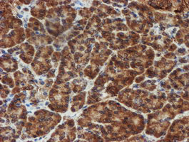 SCFD1 / SLY1 Antibody - IHC of paraffin-embedded Human pancreas tissue using anti-SCFD1 mouse monoclonal antibody.
