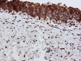 SCFD1 / SLY1 Antibody - IHC of paraffin-embedded Human bladder tissue using anti-SCFD1 mouse monoclonal antibody.