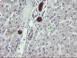 SCFD1 / SLY1 Antibody - IHC of paraffin-embedded Human liver tissue using anti-SCFD1 mouse monoclonal antibody.