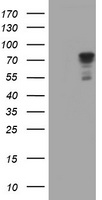 SCFD1 / SLY1 Antibody - HEK293T cells were transfected with the pCMV6-ENTRY control (Left lane) or pCMV6-ENTRY SCFD1 (Right lane) cDNA for 48 hrs and lysed. Equivalent amounts of cell lysates (5 ug per lane) were separated by SDS-PAGE and immunoblotted with anti-SCFD1.